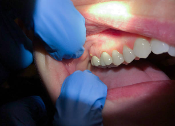 Best Emergency Treatment for Jaw Pain or Injury in Evergreen, MT
